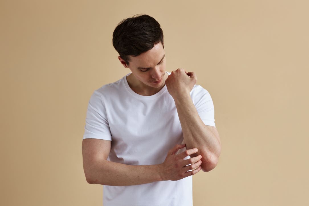 Prevenir é cuidar: checklist contra a Chikungunya