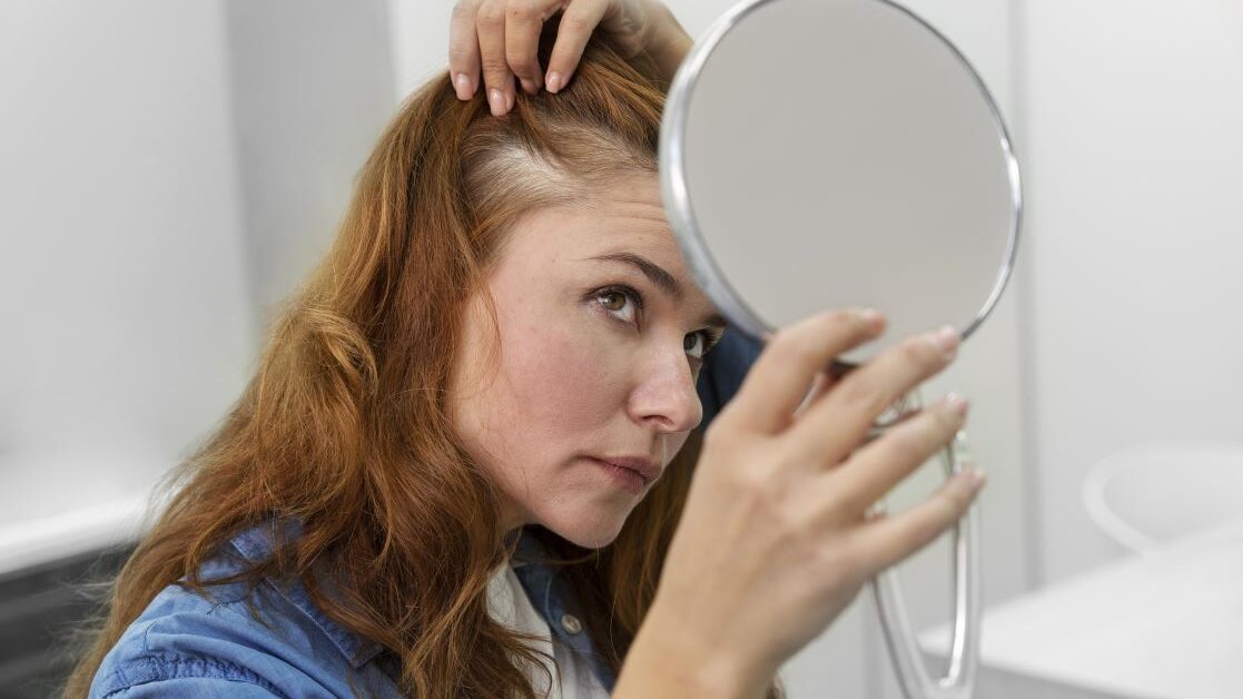 Você sabe o que é alopecia?